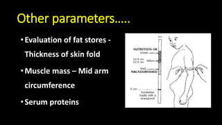 Other parameters…..
•Evaluation of fat stores -
Thickness of skin fold
•Muscle mass – Mid arm
circumference
•Serum proteins
 