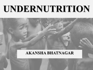 UNDERNUTRITION
AKANSHA BHATNAGAR
 
