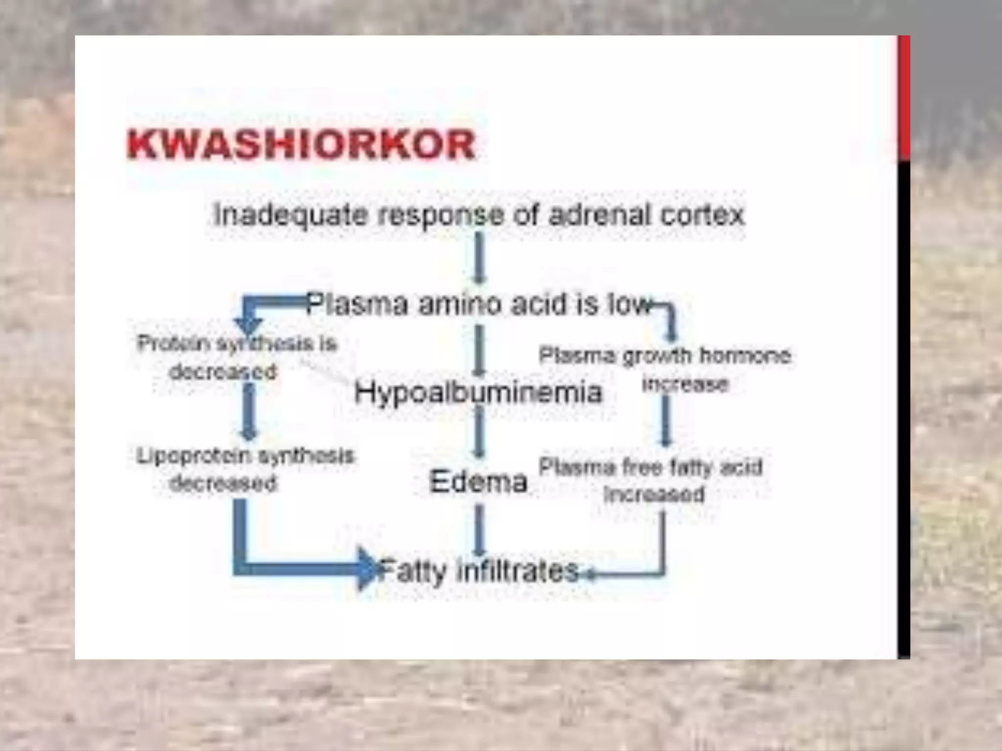 Pem etiopathogenesis | PPT
