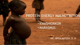 PROTEIN-ENERGY MALNUTRITION
• KWASHIORKOR
• MARASMUS
MR. ABDULMATEEN. D. H
 