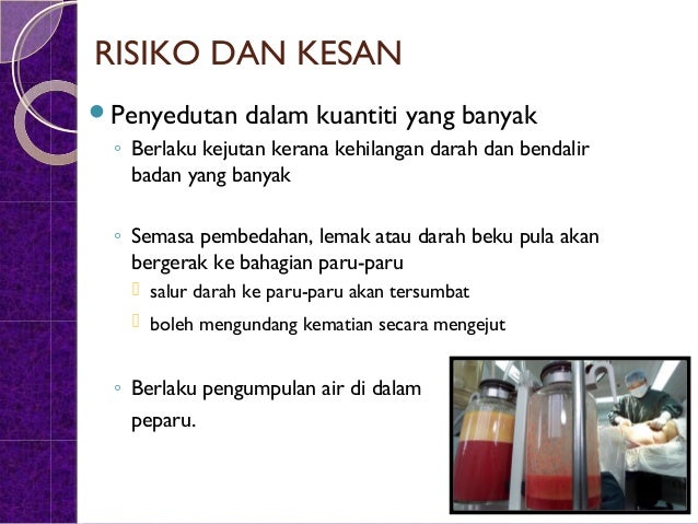 Pembedahan plastik dan jantina