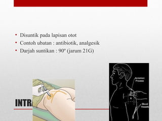 INTRAMUSKULAR
• Disuntik pada lapisan otot
• Contoh ubatan : antibiotik, analgesik
• Darjah suntikan : 90º (jarum 21G)
 