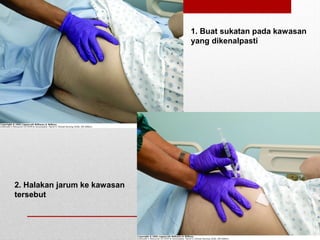 1. Buat sukatan pada kawasan
yang dikenalpasti
2. Halakan jarum ke kawasan
tersebut
 