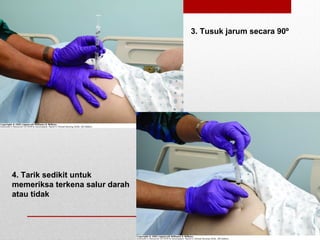 3. Tusuk jarum secara 90º
4. Tarik sedikit untuk
memeriksa terkena salur darah
atau tidak
 