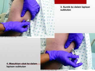 3. Suntik ke dalam lapisan
subkutan
4. Masukkan ubat ke dalam
lapisan subkutan
 