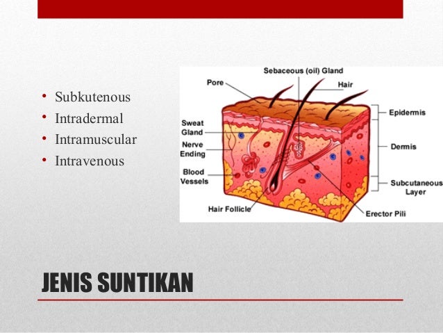PEMBERIAN UBAT PARENTERAL