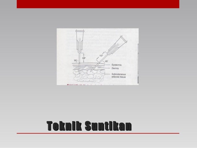 Pemberian Ubat  Parenteral Suntikan 