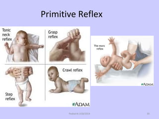 Primitive Reflex
Pediatrik UCB/2014 30
 
