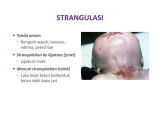 Forensik - Pembunuhan Anak Sendiri | PPTX