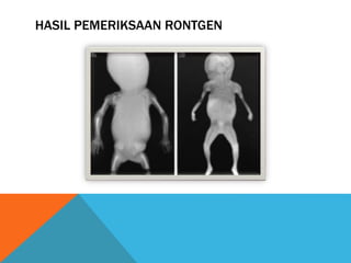 Pemeriksaan diagnostik | PPTX