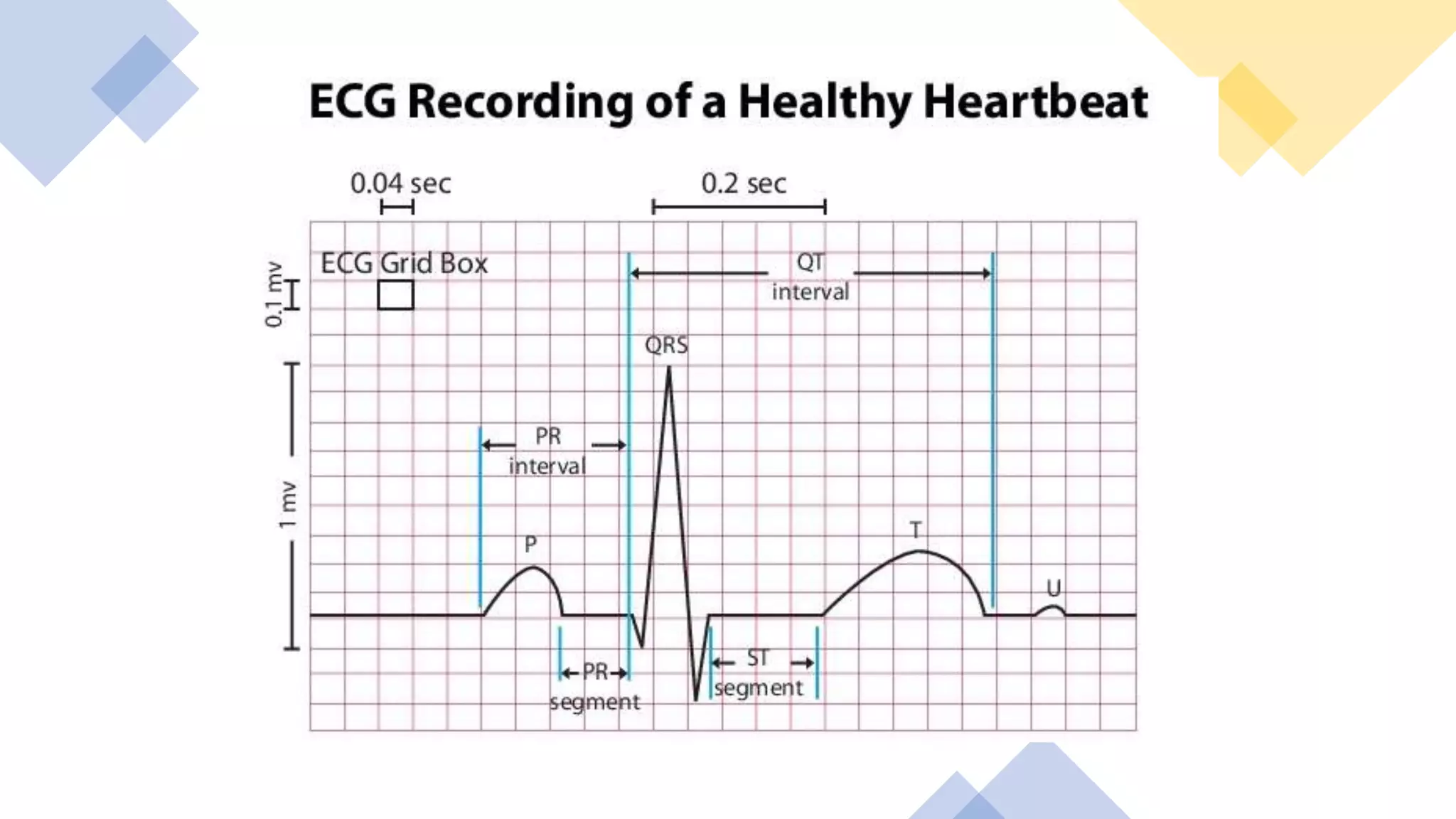 Pemeriksaan EKG.pptx