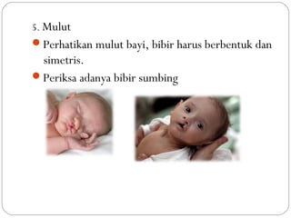 Pemeriksaan fisik bayi baru lahir