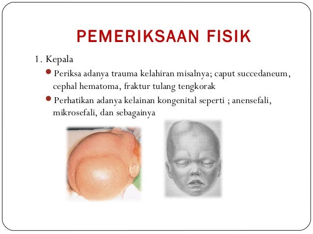 Ukuran Lingkar Kepala Bayi Baru Lahir  Berbagai Ukuran