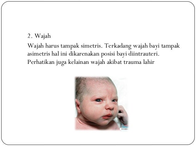 Pemeriksaan fisik bayi baru lahir Pemeriksaan fisik bayi baru lahir