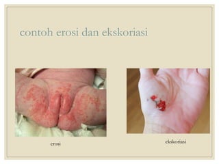 pemeriksaan fisik diagnostik kulit pada dermatologi | PPTX