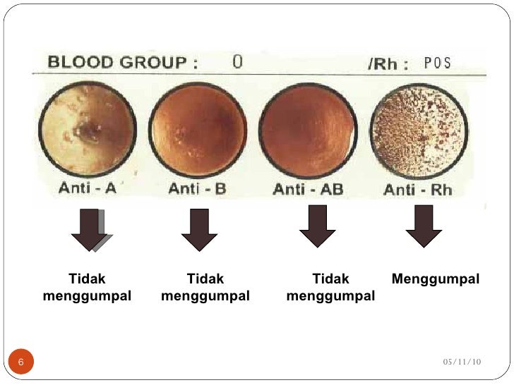 Unduh 97 Koleksi Gambar Hasil Cek Golongan Darah Terbaik Gratis HD