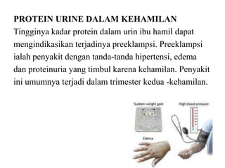 PROTEIN URINE DALAM KEHAMILAN
Tingginya kadar protein dalam urin ibu hamil dapat
mengindikasikan terjadinya preeklampsi. Preeklampsi
ialah penyakit dengan tanda-tanda hipertensi, edema
dan proteinuria yang timbul karena kehamilan. Penyakit
ini umumnya terjadi dalam trimester kedua -kehamilan.
 