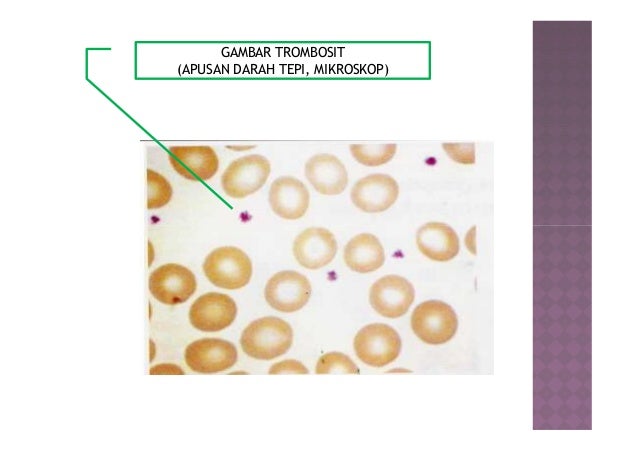 Ukuran Trombosit Darah Normal - Soalan h