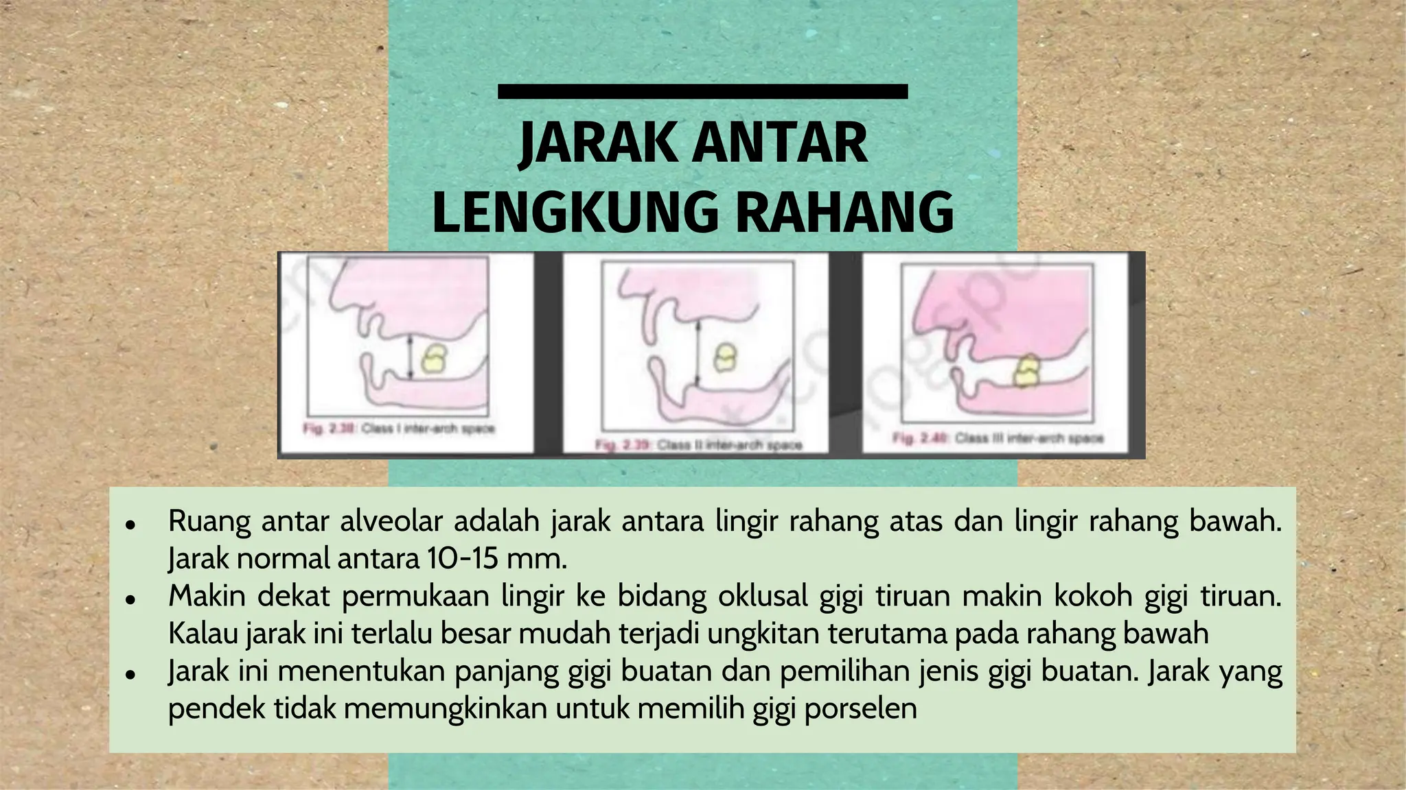 pemeriksaan klinis di bidang prostodonti.pptx