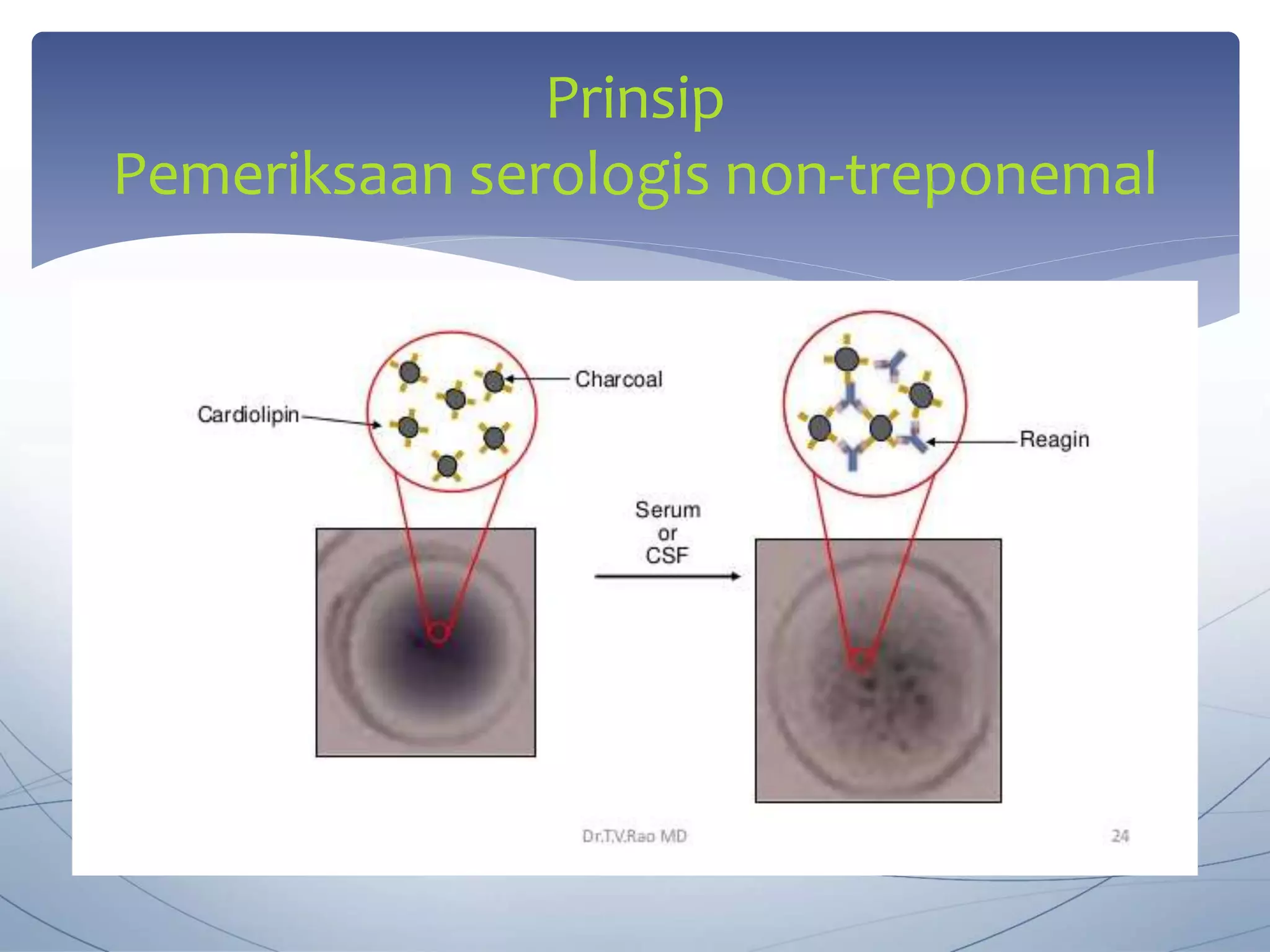 Prinsip Rpr Pemeriksaan laboratorium sifilis (1) (1).pptx