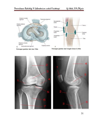 Loopografi Normal Radiologi Pemeriksaan radiologi dan laboratorium untuk fisioterapi | PDF