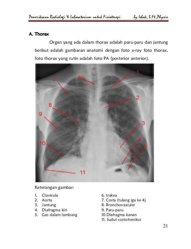 Pemeriksaan radiologi dan laboratorium untuk fisioterapi