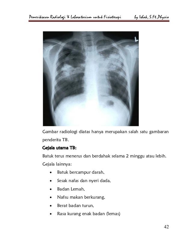 Pemeriksaan radiologi dan laboratorium untuk fisioterapi