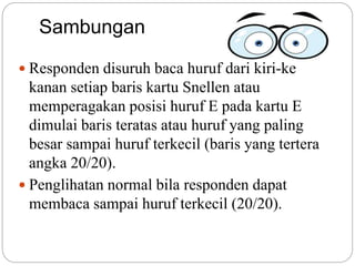 Sambungan
 Responden disuruh baca huruf dari kiri-ke
kanan setiap baris kartu Snellen atau
memperagakan posisi huruf E pada kartu E
dimulai baris teratas atau huruf yang paling
besar sampai huruf terkecil (baris yang tertera
angka 20/20).
 Penglihatan normal bila responden dapat
membaca sampai huruf terkecil (20/20).
 