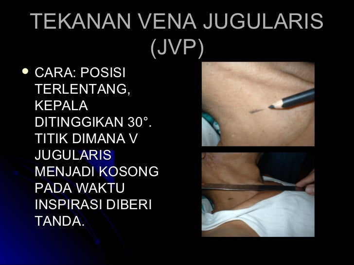 Pem fisik 20 februari