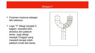 • Foramen insisivus sebagai
titik referensi
• Logo “Y” dibagi menjadi 3
bagian: mewakili bibir,
alveolus dan palatum
keras. Juga dibagi
menjadi 3 bagian yang
mewakili derajat celah
palatum lunak dan keras.
Striped-Y
 