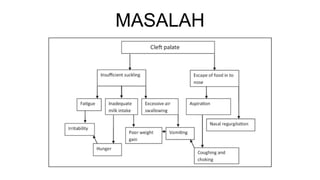 MASALAH
 