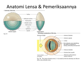 Anatomi Lensa & Pemeriksaannya
 