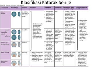 Klasifikasi Katarak Senile
 