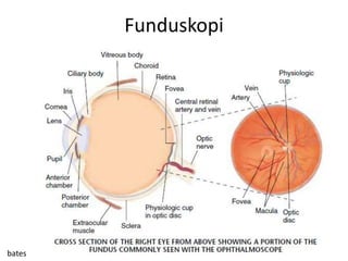 Funduskopi




bates
 