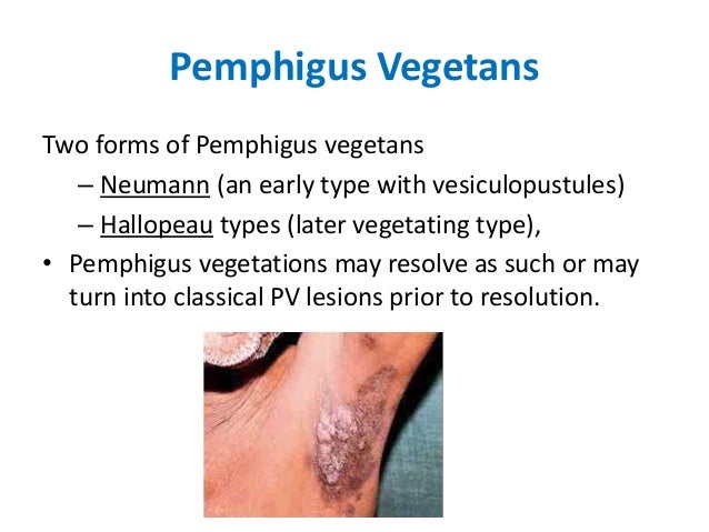 Pemphigus Disorders of skin