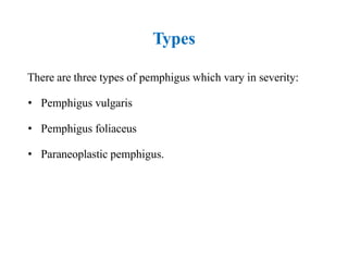 Pemphigus