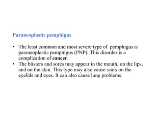 Pemphigus