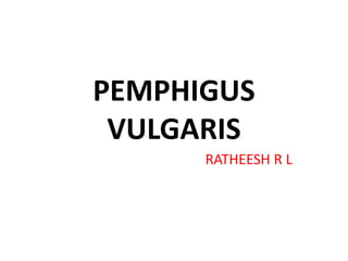 PEMPHIGUS
VULGARIS
RATHEESH R L
 