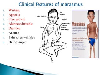 1. Wasting
2. Appetite
3. Poor growth
4. Alertness/irritable
5. Diarrhea
6. Anemia
7. Skin sores/wrinkles
8. Hair changes
 