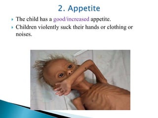  The child has a good/increased appetite.
 Children violently suck their hands or clothing or
noises.
 