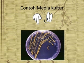 Contoh Media kultur

 
