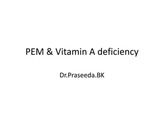 PEM & Vitamin A deficiency
Dr.Praseeda.BK
 