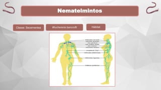 Nematelmintos
Classe: Secernentea Wuchereria bancrofti Hábitat
 
