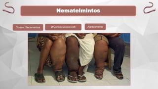Nematelmintos
Classe: Secernentea Wuchereria bancrofti Agravamento
 