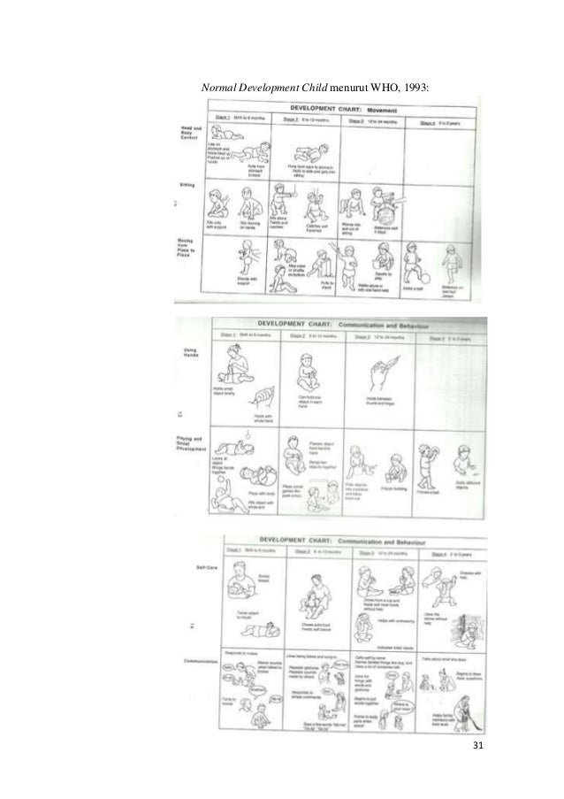 Penatalaksanaan fisioterapi pada kasus cerebral palsy 