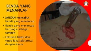 BENDA YANG
MENANCAP
• JANGAN mencabut
benda yang menancap
• Benda yang menancap
berfungsi sebagai
tampon
• Lakukan Fixasi dan
tutup luka sekitarnya
dengan Kassa
 