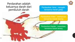 Perdarahan adalah
keluarnya darah dari
pembuluh darah
Perdarahan Vena : mengalir,
berwarna merah gelap
Perdarahan Arteri : memancar,
berwarna merah terang
Perdarahan Kapiler : merembes,
berwarna merah terang
 