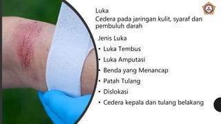 Jenis Luka
• Luka Tembus
• Luka Amputasi
• Benda yang Menancap
• Patah Tulang
• Dislokasi
• Cedera kepala dan tulang belakang
Luka
Cedera pada jaringan kulit, syaraf dan
pembuluh darah
 