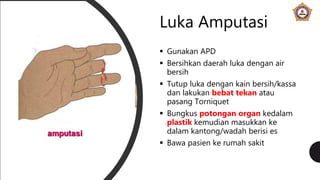 Luka Amputasi
 Gunakan APD
 Bersihkan daerah luka dengan air
bersih
 Tutup luka dengan kain bersih/kassa
dan lakukan bebat tekan atau
pasang Torniquet
 Bungkus potongan organ kedalam
plastik kemudian masukkan ke
dalam kantong/wadah berisi es
 Bawa pasien ke rumah sakit
 