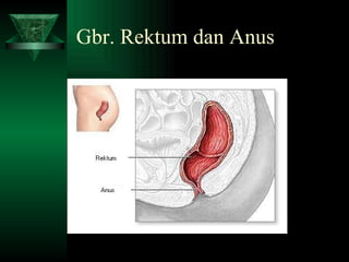 Gbr. Rektum dan Anus 